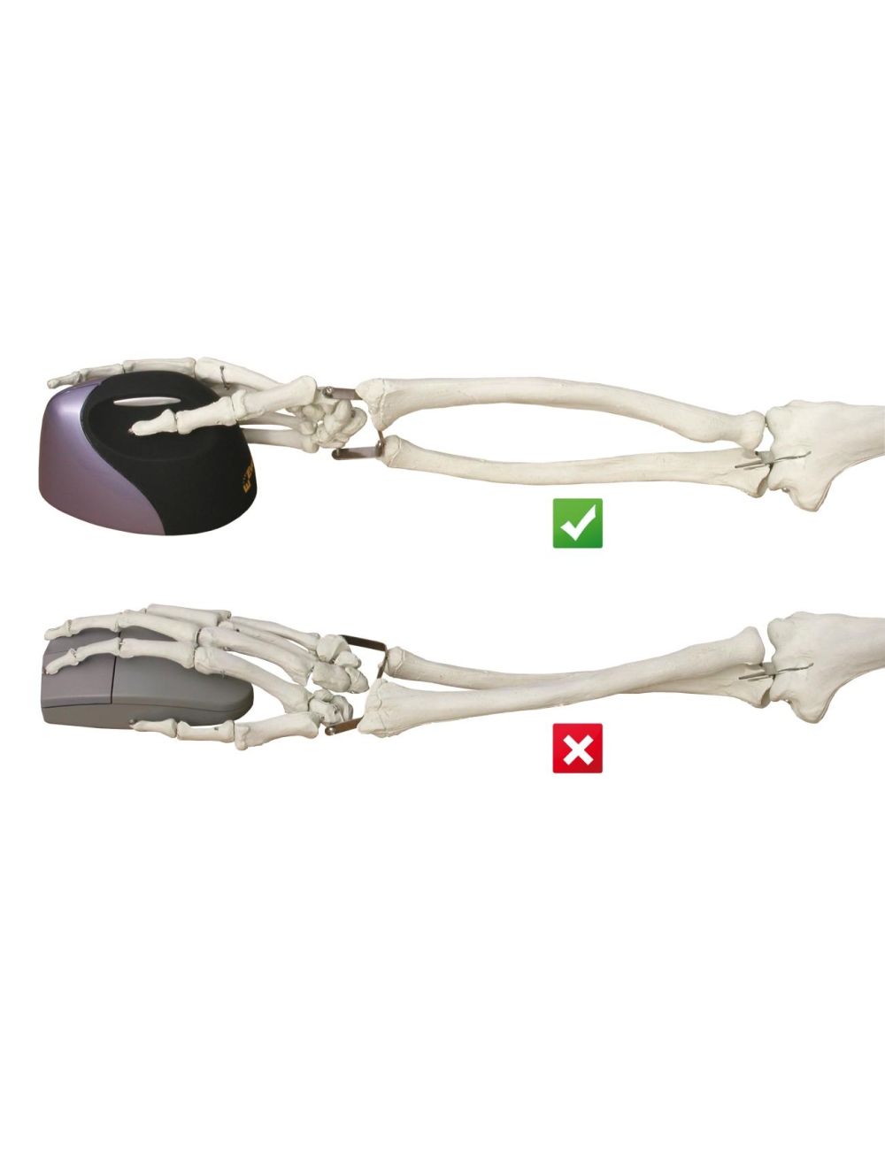 Evoluent VerticalMouse 4 Droitier Sans Fil
